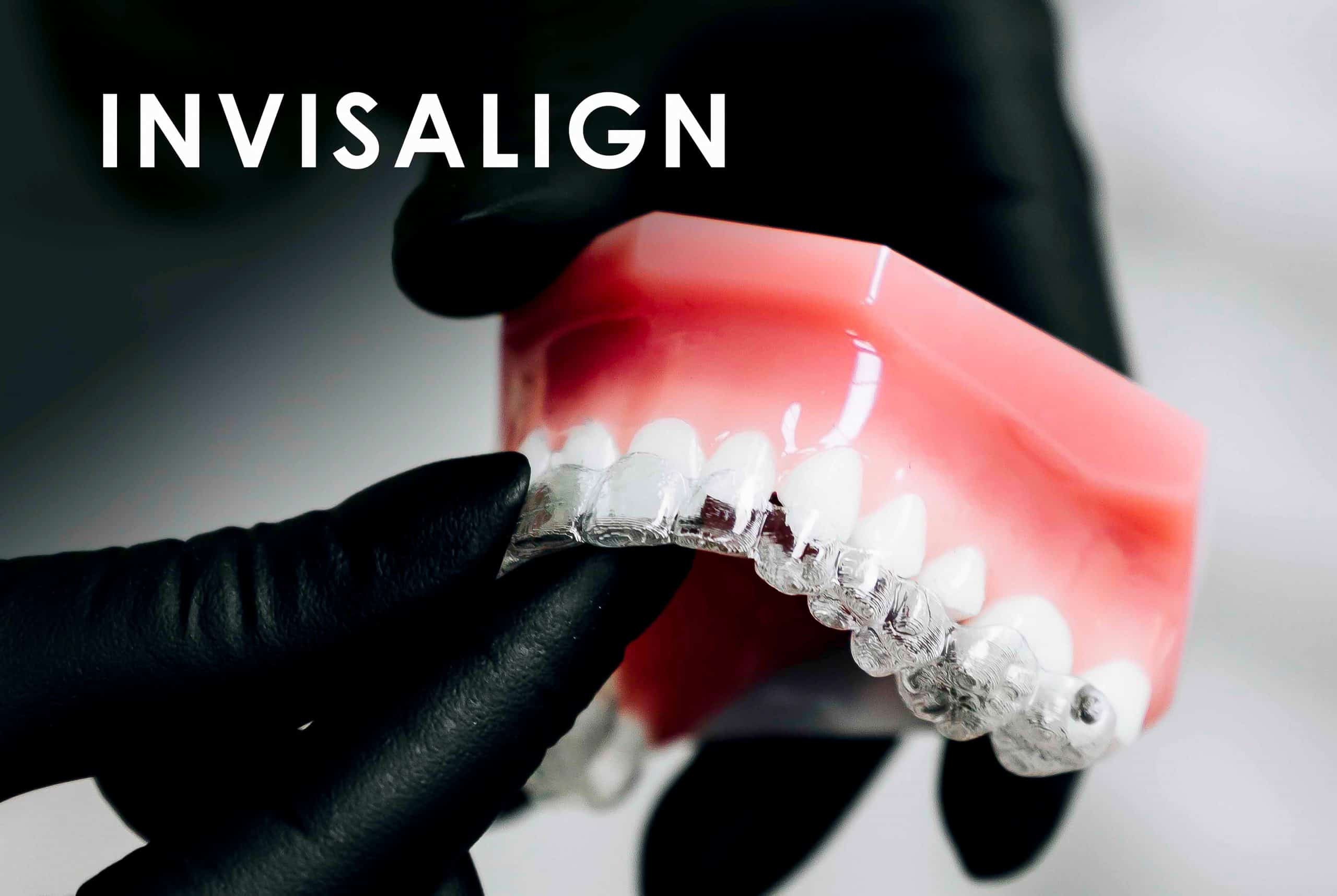 Ortodoncia Invisalign Clínica Dental Bernabeu