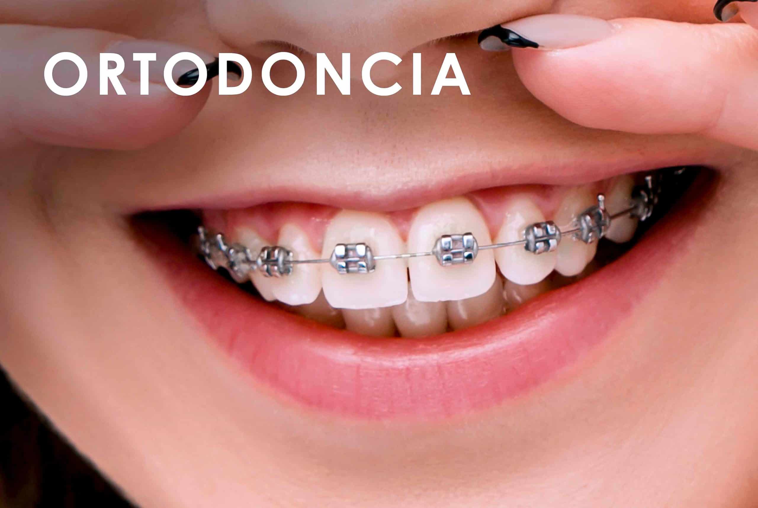 Ortodoncia Clínica Dental Bernabeu