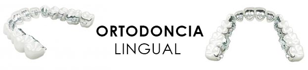 ortodoncia adultos lingual