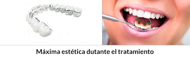 aparato dental lingual Precio