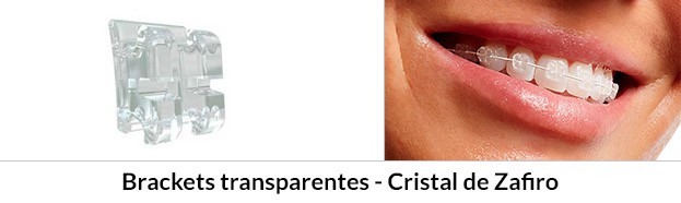 Transparente - Aparato dental