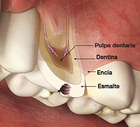 La cares dental