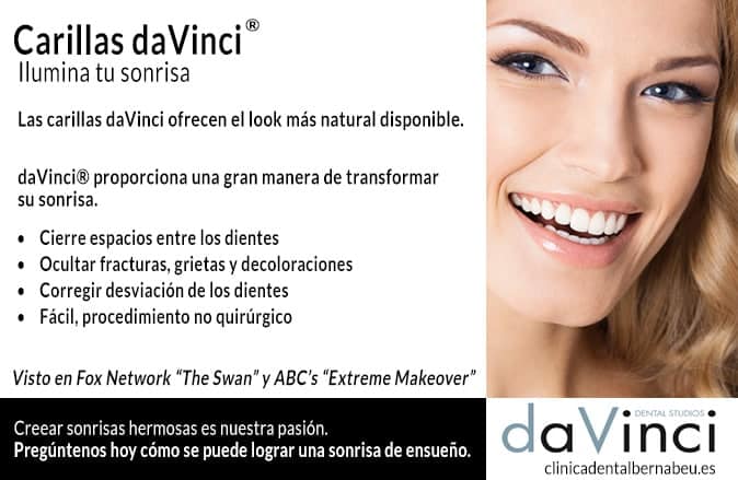 carillas dentales davinci