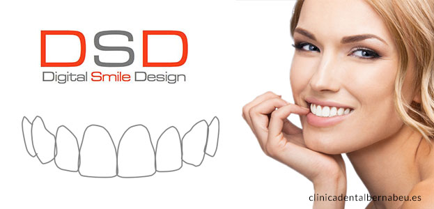 diseno sonrisas digital o DSD