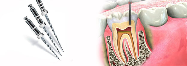 endodoncia multirradicular que es