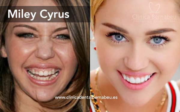 Famosos carillas cyrus