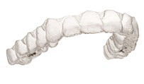 ferula dental invisalign