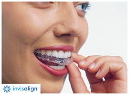 ortodoncia invisalign