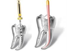 la endodoncia multirradicular